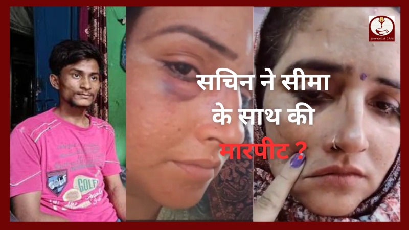 जख्मी हालत में Seema Haider का वीडियो वायरल, क्या सच में सचिन ने किया ये हाल ?